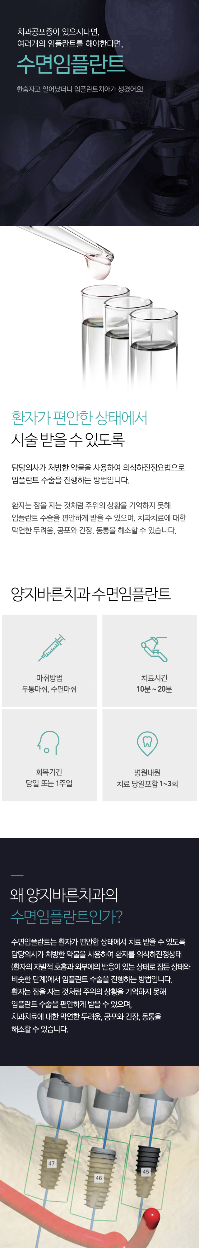 수면임플란트